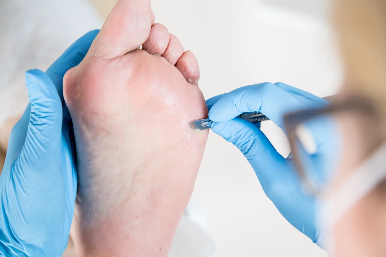 Pedicure leczniczy - czym jest, jak wygląda, kiedy warto go wybrać?