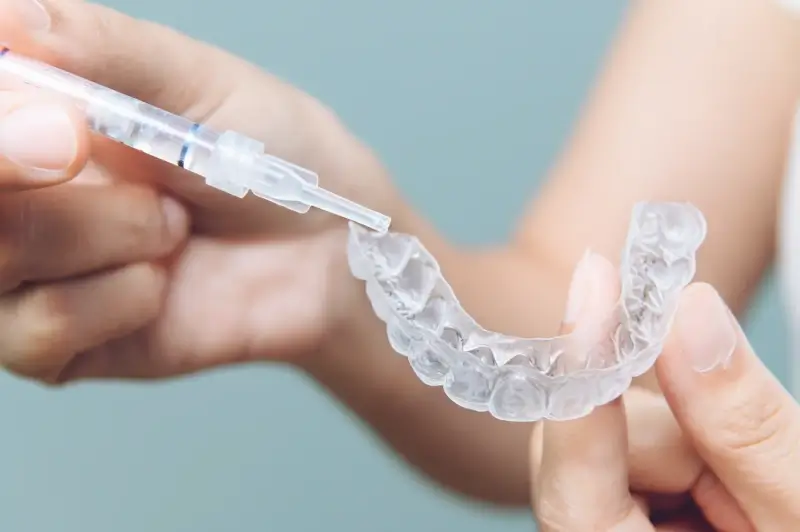 Aparat Invisalign